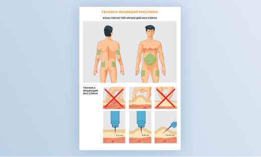 Техника инъекций